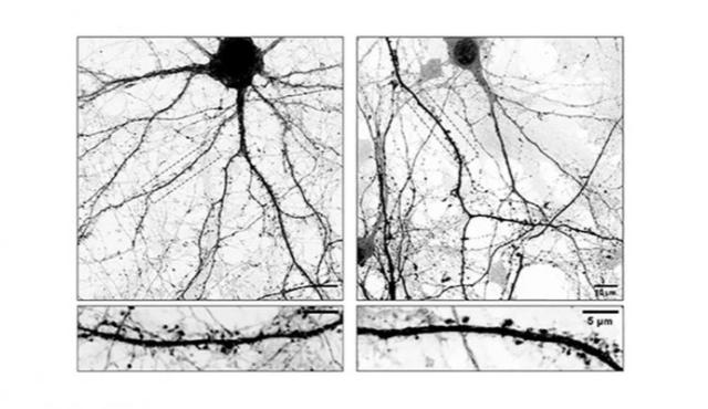 Investigadores del CONICET lograron identificar mecanismos celulares y moleculares clave involucrados en la progresión de la enfermedad de Parkinson, un avance que podría abrir un nuevo camino para optimizar las terapias actuales, que hoy se concentran mayormente en el alivio de los síntomas y no en las causas profundas de la patología.