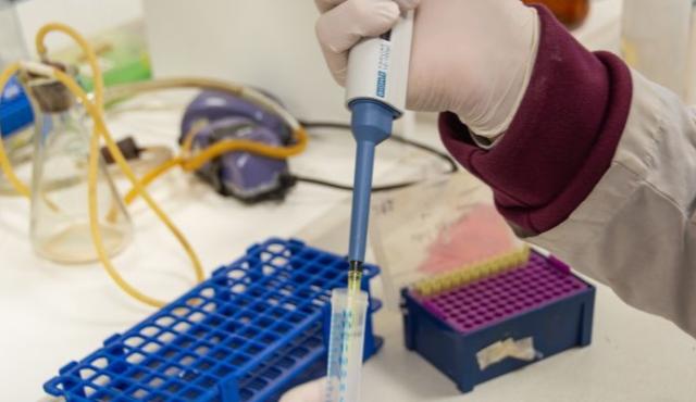 Un equipo de investigación del CONICET identificó una posible vía alternativa para el tratamiento del dolor crónico patológico a partir del estudio de medicamentos ya disponibles y utilizados originalmente para regular la presión arterial.