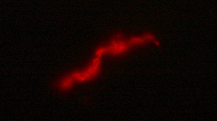 El kit FluoTB utiliza un bacteriófago que al detectar la bacteria de la tuberculosis en la muestra de esputo de un paciente produce una proteína fluorescente detectable por microscopía.